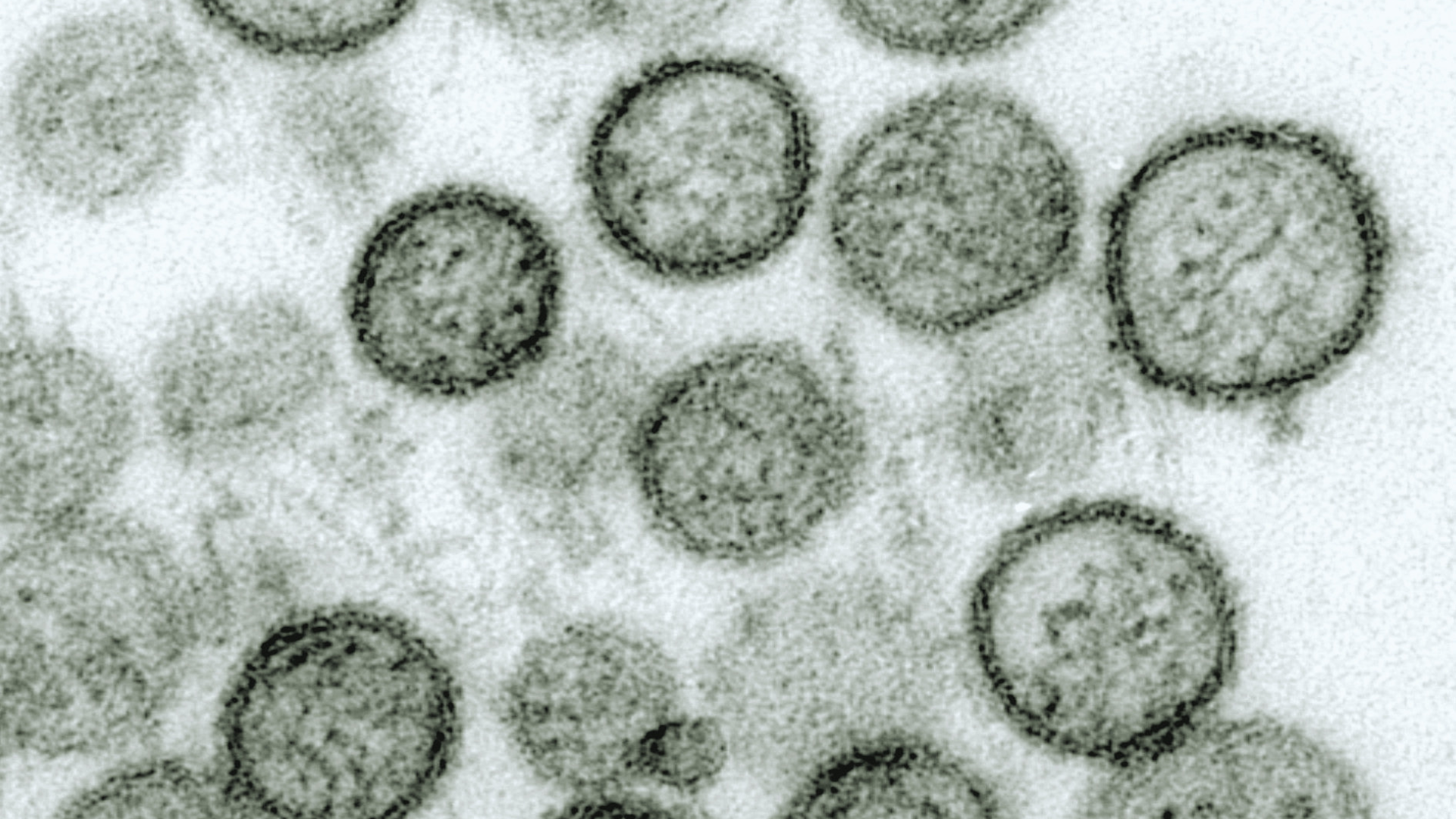Hantavirus 2026 | Outbreak News, Symptoms, and Essential Prevention Guide